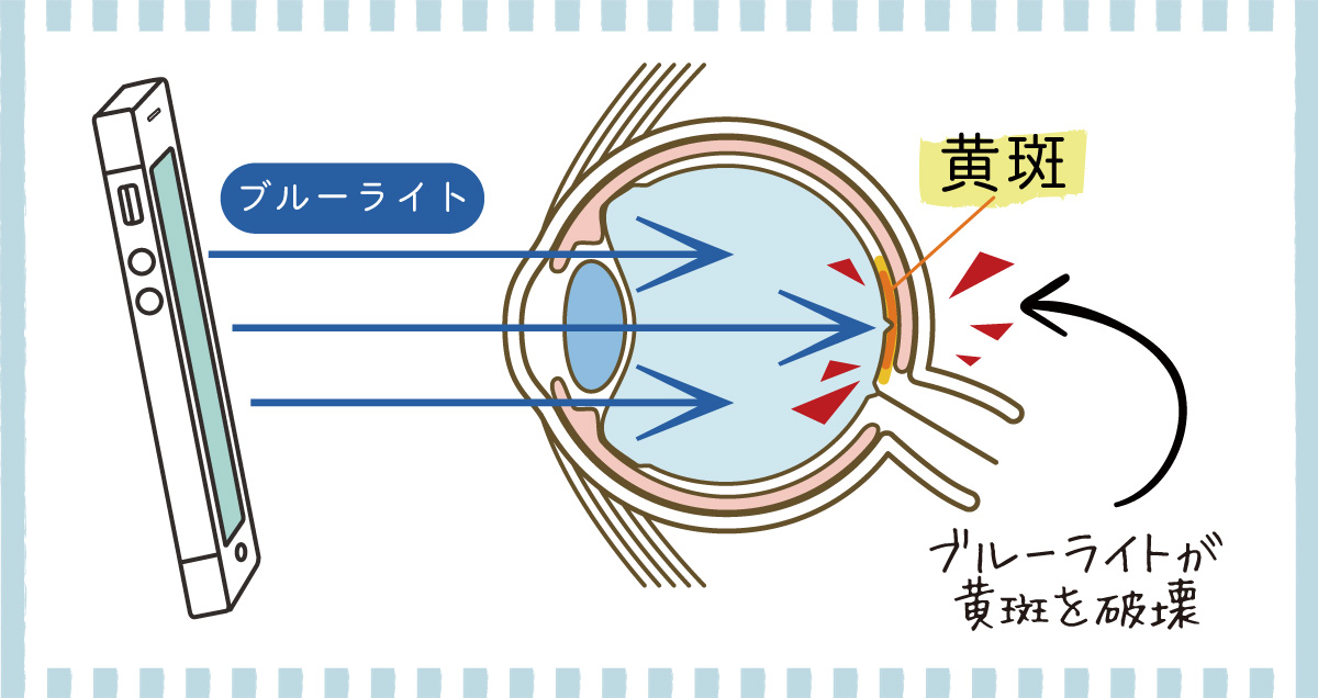 ブルーライトを浴び続けると…